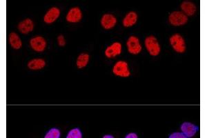 Confocal immunofluorescence analysis of HeLa cells using DNMT1 Polyclonal Antibody at dilution of 1:100. (DNMT1 抗体)