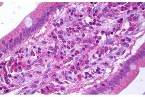Anti-VEGFR3 antibody IHC staining of human small intestine. (FLT4 抗体)