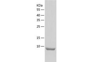 Western Blotting (WB) image for Osteocrin (OSTN) (AA 28-133) protein (His tag) (ABIN7124279) (Osteocrin Protein (OSTN) (AA 28-133) (His tag))