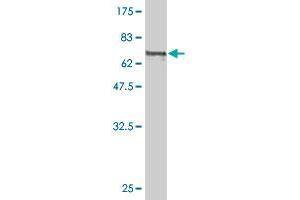 Western Blotting (WB) image for anti-Calreticulin (CALR) (AA 1-417) antibody (ABIN560152)