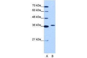 WB Suggested Anti-EXOSC7  Antibody Titration: 1. (EXOSC7 抗体  (N-Term))