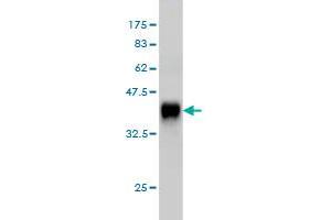 Western Blotting (WB) image for anti-Calcium Channel, Voltage-Dependent, beta 2 Subunit (CACNB2) (AA 213-301) antibody (ABIN560146)