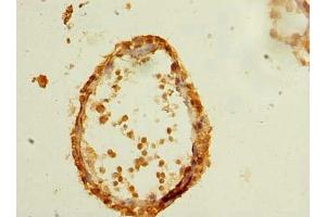 Immunohistochemistry of paraffin-embedded human testis tissue using ABIN7147768 at dilution of 1:100 (CFAP61 抗体  (AA 1-200))