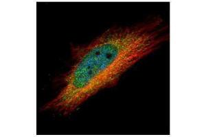 ICC/IF Image Confocal immunofluorescence analysis (Olympus FV10i) of paraformaldehyde-fixed HeLa, using IP6K1, antibody (Green) at 1:500 dilution. (IP6K1 抗体)