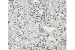 Immunohistochemistry of paraffin-embedded Rat kidney using DR1 Polyclonal Antibody at dilution of 1:100 (40x lens). (DR1 抗体)
