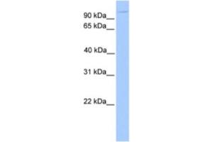 Western Blotting (WB) image for anti-Nucleoporin 98kDa (NUP98) antibody (ABIN2463586) (NUP98 抗体)