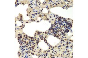 Immunohistochemistry of paraffin-embedded rat lung using DDX5 antibody (ABIN6291987) at dilution of 1:100 (40x lens). (DDX5 抗体)