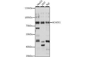 Western blot analysis of extracts of various cell lines, using  antibody (ABIN7265417) at 1:1000 dilution. (ACAD11 抗体  (AA 1-230))