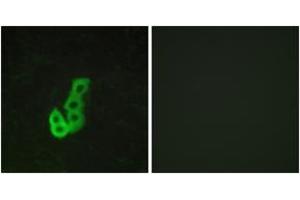 Immunofluorescence analysis of MCF7 cells, using DRD1 Antibody. (Dopamine Receptor d1 抗体  (AA 135-184))