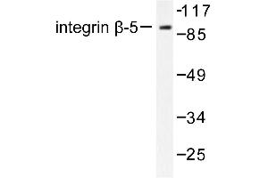 Image no. 1 for anti-Integrin beta 5 (ITGB5) antibody (ABIN265481) (Integrin beta 5 抗体)