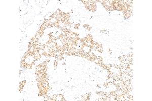Immunohistochemistry (IHC) image for anti-Protein Phosphatase 1, Regulatory (Inhibitor) Subunit 10 (PPP1R10) (AA 350-400) antibody (ABIN7454630)