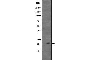 Western blot analysis of CDC42 expression in Hela cell lysate,The lane on the left is treated with the antigen-specific peptide. (CDC42 抗体  (Internal Region))