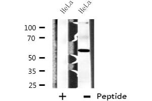 Western blot analysis of extracts from HeLa cells, using CPN2 antibody. (CPN2 抗体  (C-Term))