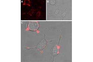 Immunocytochemistry (ICC) image for anti-Transient Receptor Potential Cation Channel, Subfamily C, Member 4 (TRPC4) (AA 458-469), (Extracellular) antibody (ABIN7043822)