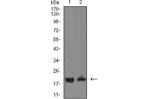 Western Blotting (WB) image for anti-CD3d Molecule, delta (CD3-TCR Complex) (CD3D) (AA 127-171) antibody (ABIN7193636)