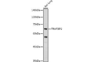 Western blot analysis of extracts of Rat lung, using TRIP2 antibody (ABIN6129947, ABIN6149464, ABIN6149465 and ABIN6222516) at 1:1000 dilution. (TRAF3IP2 抗体  (AA 1-300))