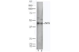 Lane 1: Human Raji lysates; Lane 2: Mouse spleen lysates probed with Rabbit Anti-ZNT8 Polyclonal Antibody, Unconjugated (ABIN1714639) at 1:300 overnight at 4˚C. (SLC30A8 抗体  (AA 101-200))
