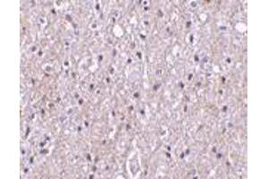 Immunohistochemistry of CTRP4 in human brain tissue with CTRP4 antibody at 10 μg/ml. (C1QTNF4 抗体  (N-Term))