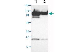 Western Blot analysis of Lane 1: RT-4 and Lane 2: U-251MG sp cell lysates with AKAP8 polyclonal antibody .