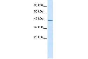 WB Suggested Anti-ZNFN1A2 Antibody Titration: 5. (IKZF2 抗体  (C-Term))