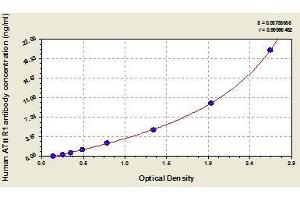 Angiotensin II Receptor, Type 1 Antibody (AGTR1 Ab) ELISA 试剂盒