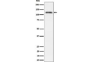 Western blot analysis of Semaphorin 4D / CD100 expression in SH-SY5Y cell lysate.