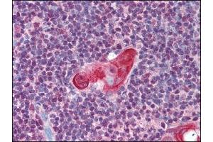 Image no. 1 for anti-T-Cell Leukemia Homeobox 1 (TLX1) (AA 300-330) antibody (ABIN372448) (TLX1 抗体  (AA 300-330))