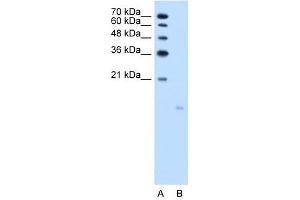 PPFIBP1 antibody used at 2. (PPFIBP1 抗体)