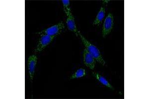 Immunofluorescence analysis of NIH/3T3 cells using HSP70 mouse mAb (green). (HSP70 抗体)