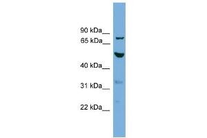 WB Suggested Anti-TUBA8 Antibody Titration: 0. (TUBA8 抗体  (N-Term))