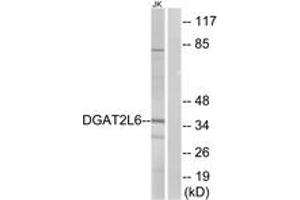 Western blot analysis of extracts from Jurkat cells, using DGAT2L6 Antibody. (DGAT2L6 抗体  (AA 271-320))