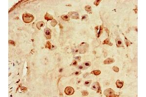 Immunohistochemistry of paraffin-embedded human placenta tissue using ABIN7167815 at dilution of 1:100 (Retinoid X Receptor gamma 抗体  (AA 13-133))