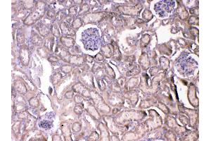 IHC analysis of VEGF Receptor 2 using anti-VEGF Receptor 2 antibody . (VEGFR2/CD309 抗体  (AA 20-244))