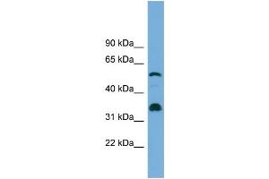 WB Suggested Anti-CYP26B1 Antibody Titration: 0. (CYP26B1 抗体  (Middle Region))