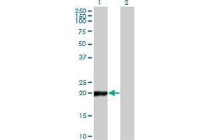 Western Blot analysis of COPS8 expression in transfected 293T cell line by COPS8 monoclonal antibody (M04), clone 2G8. (COPS8 抗体  (AA 1-209))