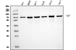Western blot analysis of Serum Response Factor/SRF using anti-Serum Response Factor/SRF antibody (ABIN7600213).