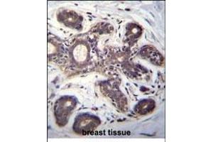Immunohistochemistry (Paraffin-embedded Sections) (IHC (p)) image for anti-Eukaryotic Translation Initiation Factor 2B, Subunit 1 Alpha, 26kDa (EIF2B1) (AA 136-163) antibody (ABIN656348)
