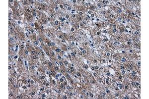 Image no. 1 for anti-V-Akt Murine Thymoma Viral Oncogene Homolog 2 (AKT2) antibody (ABIN1496564) (AKT2 抗体)