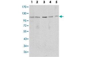 Western blot analysis using SIRT1 monoclonal antobody, clone 1F3  against MCF-7 (1), Jurkat (2), HeLa (3), HEK293 (4) and A-549 (5) cell lysate. (SIRT1 抗体)