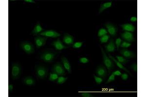 Immunofluorescence (IF) image for anti-Lysine (K)-Specific Demethylase 5B (KDM5B) (AA 231-319) antibody (ABIN1327126)