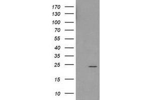 Western Blotting (WB) image for anti-Haloacid Dehalogenase-Like Hydrolase Domain Containing 1 (HDHD1) antibody (ABIN1498624) (HDHD1 抗体)
