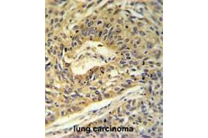 Immunohistochemistry (Paraffin-embedded Sections) (IHC (p)) image for anti-Mitochondrially Encoded ATP Synthase 6 (MT-ATP6) (AA 483-512), (C-Term), (Subunit alpha) antibody (ABIN950556)