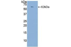 Western blot analysis of recombinant Human ACE. (Angiotensin I Converting Enzyme 1 抗体  (AA 814-1071))