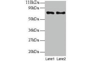 Western blot All lanes: TAX1BP3 antibody at 2 μg/mL Lane 1: EC109 whole cell lysate Lane 2: 293T whole cell lysate Secondary Goat polyclonal to rabbit IgG at 1/15000 dilution Predicted band size: 14 kDa Observed band size: 70 kDa (TAX1BP3 抗体  (AA 1-124))