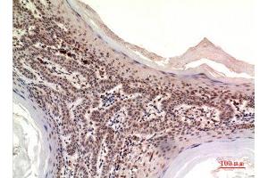 Immunohistochemistry (IHC) analysis of paraffin-embedded Human Skin, antibody was diluted at 1:100. (NOV 抗体  (Internal Region))