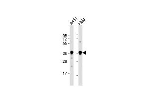 Western Blotting (WB) image for anti-Glyceraldehyde-3-Phosphate Dehydrogenase (GAPDH) (AA 233-259), (C-Term) antibody (ABIN392354)