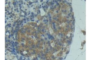 Detection of FASL in Rat Pancreas Tissue using Polyclonal Antibody to Factor Related Apoptosis Ligand (FASL) (FASL 抗体  (AA 100-278))