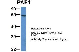 Host: Rabbit  Target Name: PAF1  Sample Tissue: Human Fetal Heart  Antibody Dilution: 1. (PAF1/PD2 抗体  (N-Term))