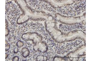 Immunoperoxidase of monoclonal antibody to MEF2A on formalin-fixed paraffin-embedded human small Intestine. (MEF2A 抗体  (AA 71-170))