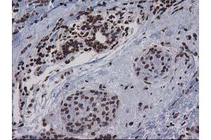 Image no. 6 for anti-CTD (Carboxy-terminal Domain, RNA Polymerase II, Polypeptide A) Small Phosphatase 1 (CTDSP1) antibody (ABIN1497679) (CTDSP1 抗体)